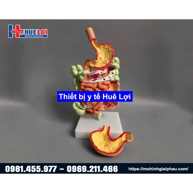 Mô hình giải phẫu hệ tiêu hóa 3D